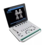 Healicom THBW-9 Portable Full Digital Laptop Ultrasound Machine